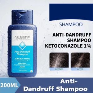 Nizoral Anti Dandruff Shampoo Ketoconazole Scalp Hair Treatment Dry Hair Care Oil Control Shampoo