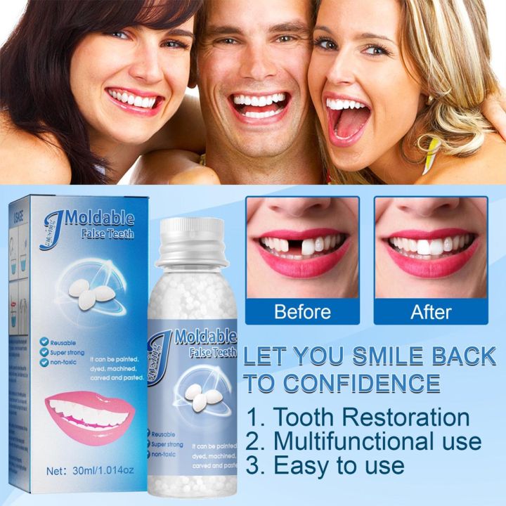 30ML%20Temporary%20Tooth%20Repair%20Kit%20Teeth%20and%20Gaps%20Moldable%20Falseteeth%20Solid%20Glue%20Denture%20Adhesive%20-%20Image%207