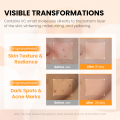 JellyPrim Vitamin C Whitening Face Cream Fading Melasma Dark Spots Acne Marks Moisturiser Non-Greasy Niacinamide Brightening Anti Aging Moisturizing Creams Beauty Skincare 45g. 