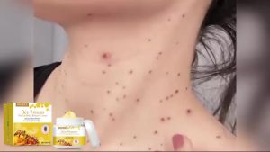 🌟🌟🌟Houkea Bee Venom Care Cream Gentle Formula Lubricating Skin Tender Cleansing Brightening Repairing Skin Nourishing Cream