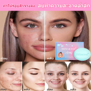【 ขจัดสิวและลดรอยสิวภายในคืนเดียว】สบู่ทำความสะอาดล้ำลึกและให้ความชุ่มชื้น/สบู่ให้ความชุ่มชื้นเพื่อการทําความสะอาดอย่างล้ําลึกและแก้ปัญหารอยแสง ทําให้รอยสิวจางลง