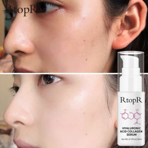 RtopR Serum Collagen tinh chất hyaluronic acid dưỡng ẩm mụn trứng cá chống nhăn chăm sóc da sau khi giảm mụn trứng cá - intl