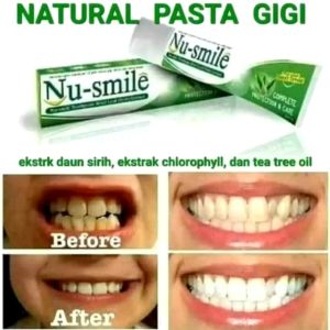 BBM-pasta gigi NU SMILE (exstrak Daun sirih)