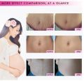 Vova Strechmark cream krim penghilang stretchmark stretchmark selulit. 