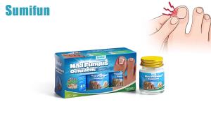 Sumifun  Yingrou Ingrown Toenail Treatment Ointment   Onychomycosis and Nail Fungus Treatment   Cross-Border Russian Foreign Trade V30004
