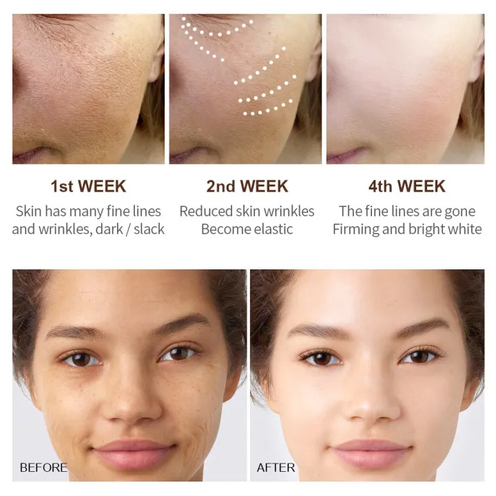 VIBRANT%20GLAMOUR%20Natural%20Retinol%20Sets%20Face%20Cream+Facial%20Serum+Retinol%20Toner+Retinol%20Lotion%20+%20Eye%20Cream%20+%20Eye%20Serum%20%7C%20Retinol%20VA%20Anti%20Aging%20Whitening%20Renewing%20Skin%20Hyaluronic%20Acid%20Reduce%20Fine%20Lines%20Wrinkles%206%20Pieces%20-%20Image%202