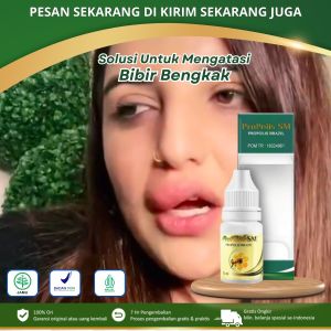 PROPOLIS SM - Obat Bibir Bengkak Bibir Bengkak Akibat Alergi Bibir Luka Radang Bibir Bibir Pecah-Pecah Pengempis Bibir Bengkak