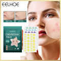 Eelhoe Colorful Acne Patch Star Pimple Patch Acne Coloful Invisible Acne Removal Stickers Originality Concealer Face Spot Beauty Makeup Tool L Invisible Acne Removal Pimple Patch Beauty Acne Tools Pimple Acne Concealer Face Spot Scar Care Stick(122pcs). 