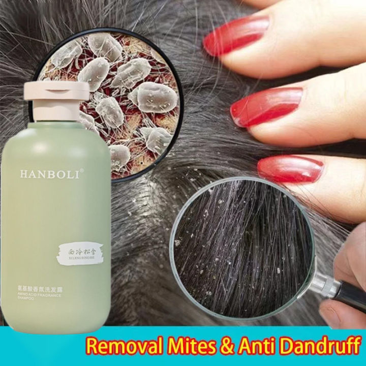 Anti Dandruff shampoo, Dandruff Remover, Anti Fungal, Anti Itchy Japan