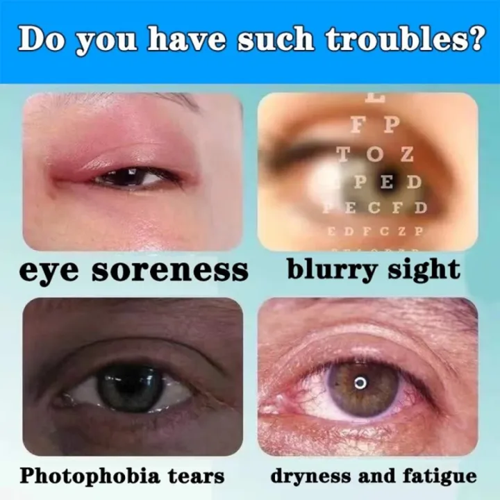 Japan%20Astigmatism%20Short-Sighted%20Eye%20Drops%20Dry%20Eye%20Relief%20Cure%20Sore%20Eyes%20And%20Blurred%20Vision%20Ubat%20Mata%20Rabun%20Ubat%20Mata%20Selaput%20Penawar%20Mata%20Eye%20Care%20Original%20%E7%9C%BC%E8%8D%AF%E6%B0%B4%20-%20Image%203