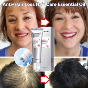 Hair Growth Essence Anti-Hair Loss Hair Care Essential Oil Nourishing Hair Roller Massage Scalp Serum