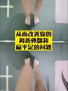 【SG 🚚】Foot Arch Trainer For Flat Feet And Thumb Valgus Correction TPR Yoga Fitness Leg Shaping Tool