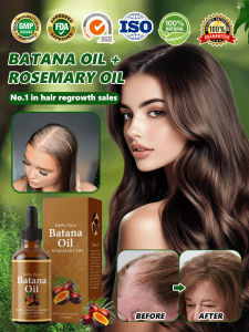✨Care Essential Oil/Hair Growth Oil/Hair Oil/Nourishing Oil/Nourish Hair/Promote Hair Growth/Rosemary Oil/Rosemary Leaf/Batana Fruit/Hair Care  Hair Growth Best Seller Batana Rosemary Essential Oil
