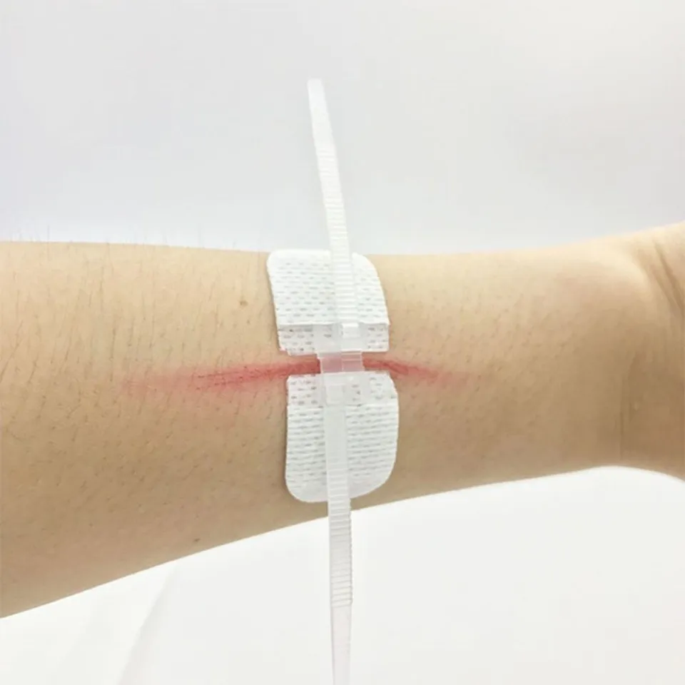 Bandage Band Aid Zip Stitches Zip Tie Wound Closure Adhesive