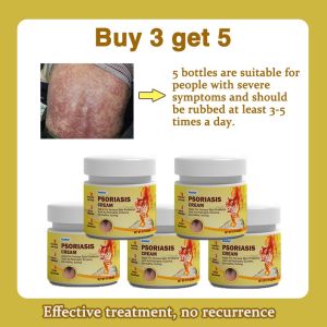 Itchy Skin Relief Cream Antibacterial Cream 20g Skin Anti Itch Cream For Skin Quick Itching Relief Ubat Celah Kangkang Gatal Private Parts Antifungal Cream Anti-Itching Cream Eczema Psoriasis Cream 3 Seconds Of Rapid Itch Relief Safe And Effective
