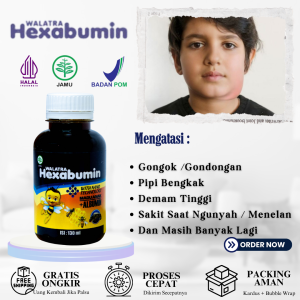 Obat Gondok/Gondongan Pada Anak Obat Pipi Bengkak Obat Pembengkakan Kelenjar Parotis Obat Sakit Saat Ngunyah/Menelan Makanan Obat Panas Dalam Anak Obat Demam Tinggi Anak - 130 ML