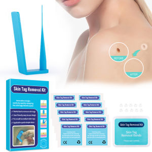 MELEDE Blue Set Skin Tag Removal Kit Home Use Mole Wart Remover Equipment Micro Skin Tag Treatment Tool Easy To Clean Skin Care Tool