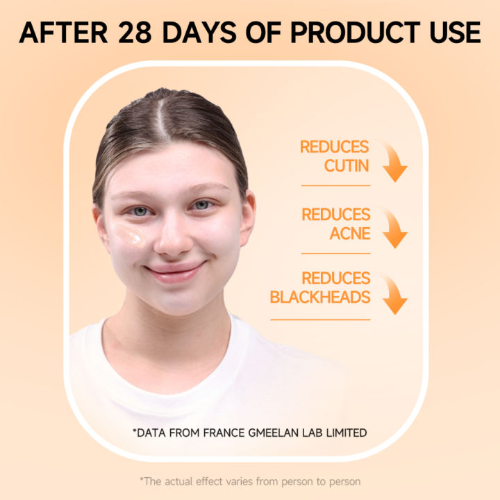 Sunisa%20100g%20Orange%20Exfoliating%20Whitening%20Gel%20for%20Skin%20Cleansing%20Whitening%20Body%20Milk%20-%20Image%206