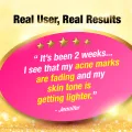 [2 Packs] AFC Collagen White Beauty Skin Supplement - Whitening for Fair & Bright Face Lighten Dark Spots Acne Scars Pigmentation with Glutathione + Vitamin C + L Cystine • Made in Japan • 270 Caplets (Suitable for All Skin Types). 