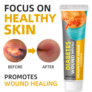 Elderly Diabetic Wound Treatment Cream Moxibustion Enhanced Formula for Effective Recovery