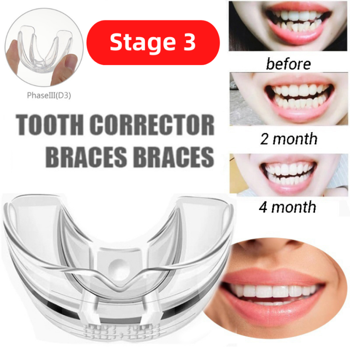 【Stage 3】1Pcs Teeth Orthodontic Aligner Straightener or Alignment Braces 3 Phases Transparent