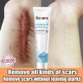 Scar gel remover scar remover cream scar remover for old scar on leg peklat remover cream for old peklat (softens scar tissue and promotes natural skin healing and renewal) ccgray cream. 