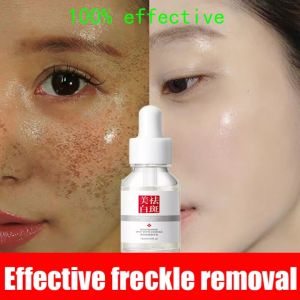 Effective Freckle Serum Remove Dark Spots Witening Serum Fade Acne Scars Melasma Anti-Aging Skin Lightening 20g-cream Pemutih-wajah Glowing Krim-cream Penghilang Flek -wajah Serum Siang Malam -cream Wajah Glowing