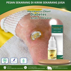 Propolis SM Obat Tetes Luka Diabetes Luka Diabetes Bernanah Obat Luka Diabetes Kering Luka Diabetes Basah Pengering Luka Diabetes