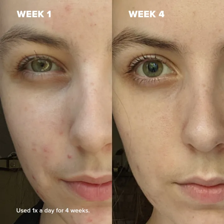 Paula's%20Choice%20Vitamin%20C15%20Super%20Booster%20Serum%20%7C%20Brightening,%20Firming%20&%20Anti-Aging%20Serum%20for%20Radiant%20Skin%20-%20Image%204