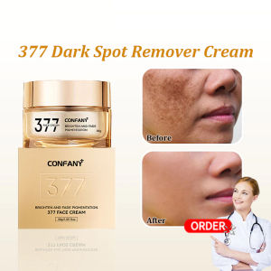Cream Dark Spot 30g 377 Dark Spot Remover Cream remove Melasma Degil Penghilang Flek Hitam Cepat 377美白淡斑面霜