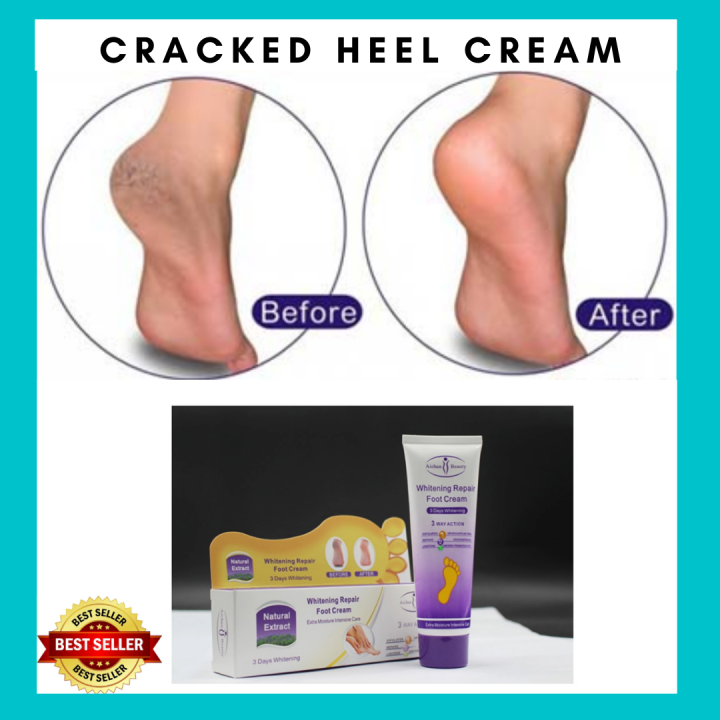 Buy HARSHLOVE Foot Repair serum for Rough, Dry and Cracked Heels For Men &  Women Pack of 1 Online at Best Prices in India - JioMart.