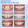 30ML Temporary Tooth Repair Kit Teeth and Gaps Moldable Falseteeth Solid Glue Denture Adhesive. 