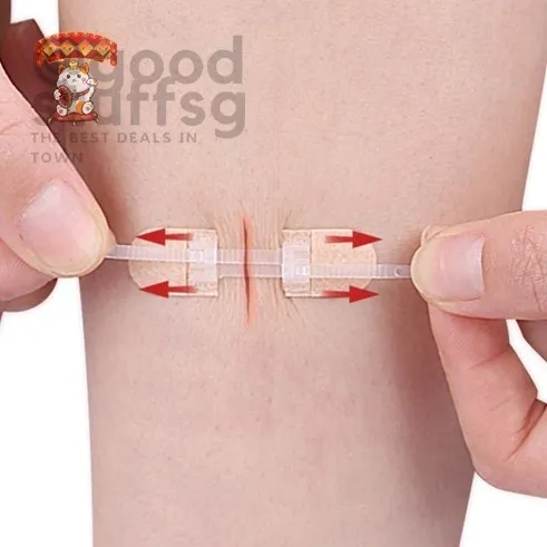 [SG FREE ] Strap Zipper Wound Closure Patches Breathable Seamless ...