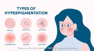 NeoStrata Enlighten Dark Spot Corrector 20g