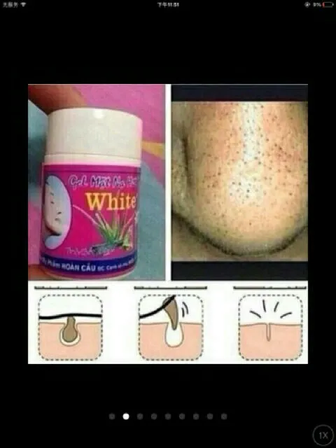 Clear%20nose%20white%20Blackheads%20remover%20cream%20Thai%20gel%20mat%20-%20Image%202
