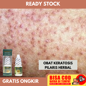 Obat Penghilang Bintik Hitam Dikulit - Penghilang Bintik Hitam di Pantat - Keratosis Pilaris - Salep bintik seperti jerawat di badan - bercak kasar dan benjolan kecil seperti jerawat pada kulit dengan Propolis Brazil SM Original