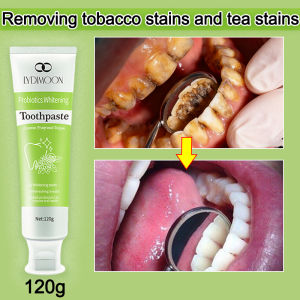 LYDIMOON Whitening toothpaste Teeth whitening with probiotics for removing stubborn stains Fresh Breath Remove Tooth Stains Yellow Tooth Whitening restores damaged gums and Prevent Caries