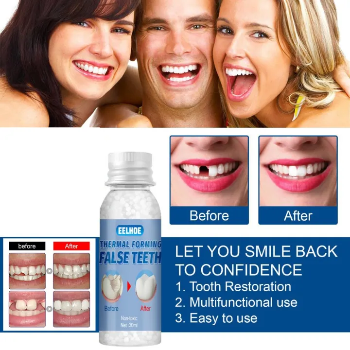 10/20/30G%20Teeth%20Solid%20Glue%20Denture%20Filling%20Solid%20Gel%20Denture%20Adhesive%20Glue%20Temporary%20Tooth%20Repair%20Kit%20Teeth%20Solid%20Glue%20Tooth%20Replacement%20%20Tools%20Oral%20Care%20-%20Image%203