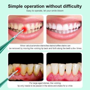 Ultrasonic Dental Scaler Teeth Whitening Device Dental Calculus Yellow Teeth Tartar Cleaner Fresh Breath Teeth Cleaning Oral Care IPX6 Waterproof USB Charging