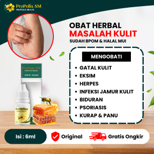 Obat Gatal2 - Panu Kadas Kurap Kudis Eksim Kering Eksim Basah Biduran Infeksi Jamur Kulit Herpes Cacar Air Psoriasis Kulit Kering Bersisik  Propolis SM Herbal Alami