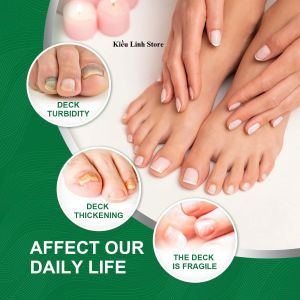 [ SIÊU ƯU ĐÃI ] Nấm Móng Tay Móng Chân Dạng Xịt Giúp Giảm Nấm Dưỡng Móng Tay Móng Chân Kháng Khuẩn Giảm Đau Nhức