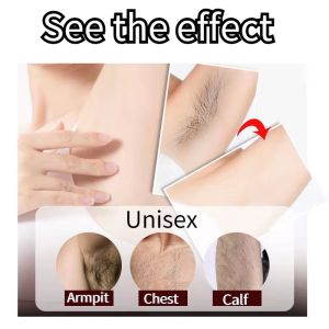 Hair removal cream 100g hair removal face mask permanent hair removal Hand Armpit Thigh full body hair removal Mild and non-irritating fast hair removal leave no trace inhibit hair growth