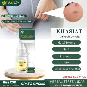 Obat Oles Cair Gatal Bokong Bisul Bernanah Jamur Selakangan Lecet Herpes Kutil Korengan Pantat Burik Jerawat Bruntusan Fistula Ani Benjolan Anus Ambeien Abses Anus Iritasi Kulit Eksim Kulit Kering Bersisik Psoriasis Kurap Propolis SM