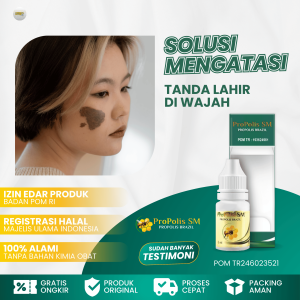 Obat Penghilang Tanda Lahir Obat Tanda Lahir Coklat Di Wajah Obat Penghilang Tanda Lahir Hitam Di Muka Obat Tanda Lahir Merah Obat Tanda Lahir Menonjol Hemangioma Memudarkan Tanda Lahir Hitam Dengan Propolis SM