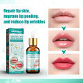 South Moon Lip Lightening Liquid Whitening Cream Pink Lips Nourish Protect Hydrated Maintenance Herbal Lip Balm Lip Care Beauty Makeup Remedy Lightening Cream Brighten Lip Color Peeling Lip Balm For Repairing Lip Line Hydrating Lip Products Overnight. 
