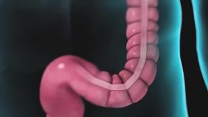 Men vi sinh chứa Bào tử lợi khuẩn dùg cho Viêm Đại Tràng Tiêu chảy Táo bón - LiveSpo Colon(10 ống)