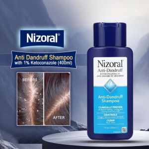 Nizoral Anti Dandruff Shampoo 200ML With Ketoconazole 1% Scalp Hair Treatment Dry Hair Care Shampoo