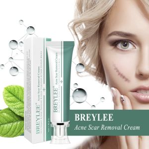 【Local Stock】BREYLEE Treatment Remove Scar Removal Cream Stretch Marks Remove Cream 30g