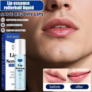 Lip Essence Roll-On Moisturizes Fade Dead Skin Lip Soothing And Repairing Anti-drying Anti-Chapped Cae Lip Lines