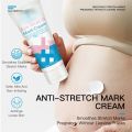 Anti-Stretch Mark Cream Dark Spot Remover Cellulite Remover Anti Scar Cream Firming Skin Cream Whitening Fades stretch marks Pregnancy repair cream Scars Repair Maternity Skin Repair Treatmen. 
